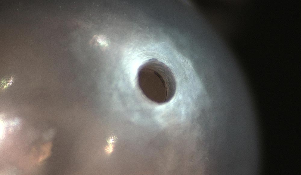 有核淡水真珠のレントゲンによる巻き厚測定